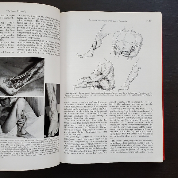 Vintage 1977 2nd Ed Reconstructive Plastic Surgery Vol 7 Medical Hardcover Book - Picture 8 of 8